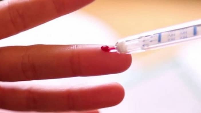#VIH Sida : Comment réaliser soi-même un auto test ?
