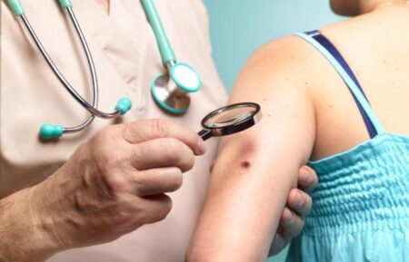 Cancer de la peau des scientifiques trouvent comment stopper la propagation du melanome