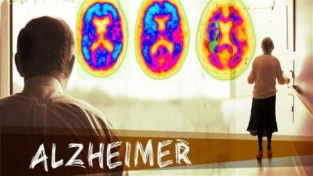 un traitement prometteur pour les patients atteints de l’Alzheimer