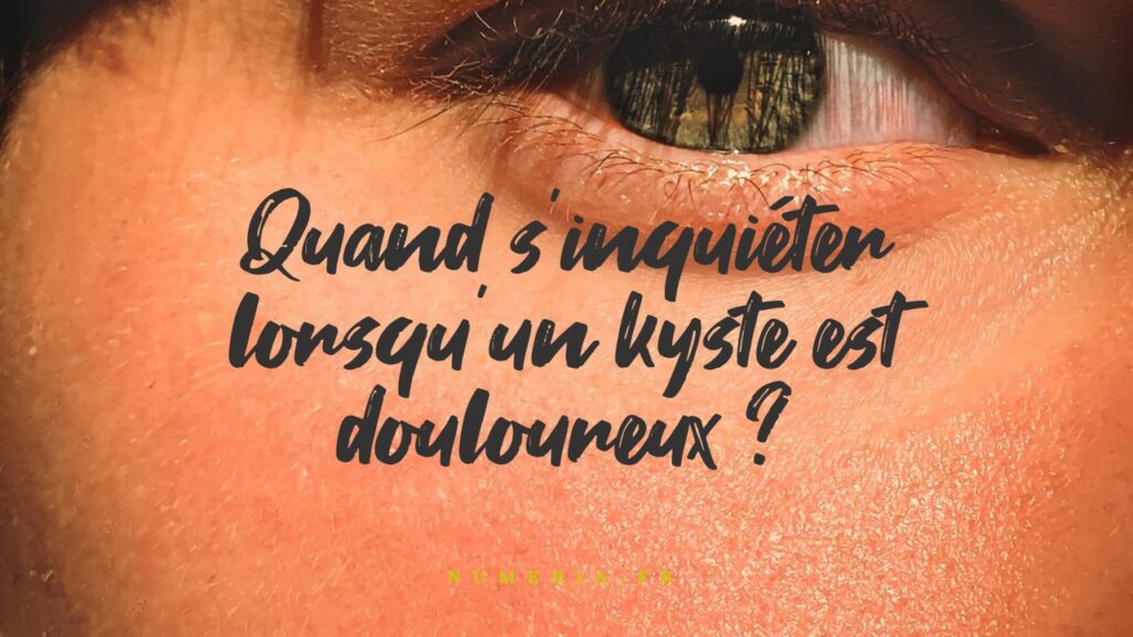 Quand s'inquiéter lorsqu'un kyste est douloureux ?