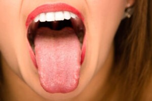 Les langues ondulées et la santé