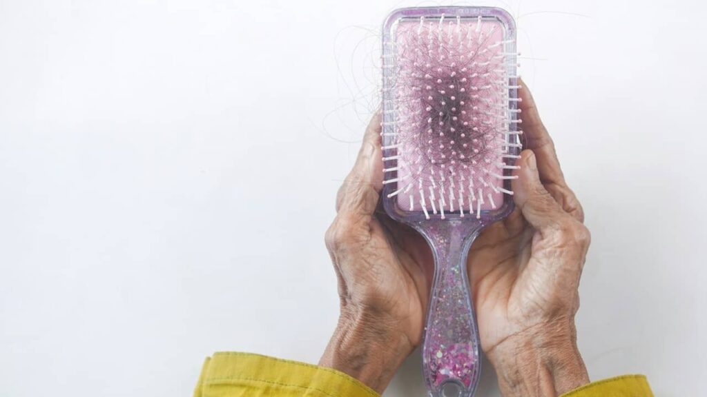 perte-de-cheveux-brosse (1)