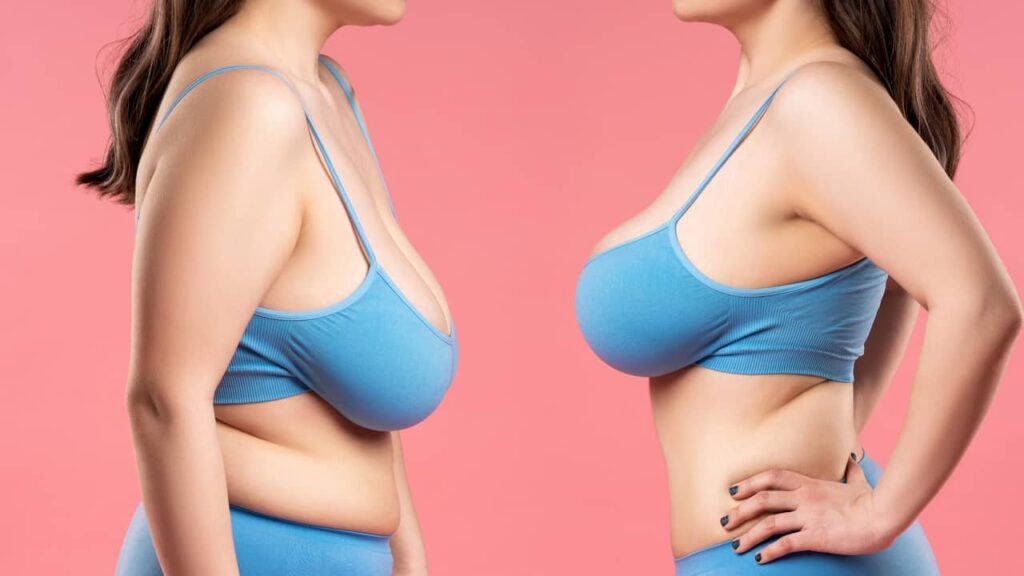 femme poitrine avec et sans implants