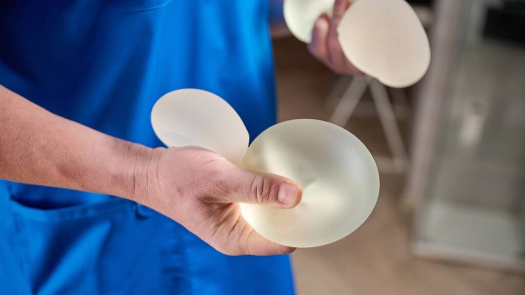 implants mammaires