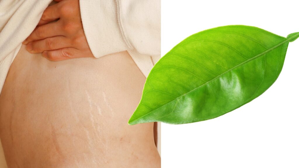 formes paralleles nature corps